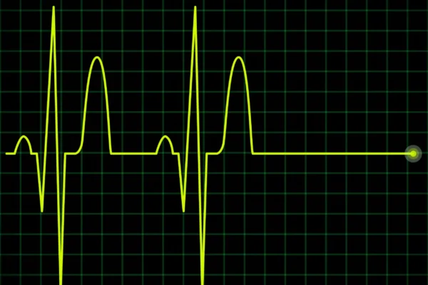 Yellow EKG waveform on a green grid, showing heart rhythm patterns, used for monitoring heart health at home