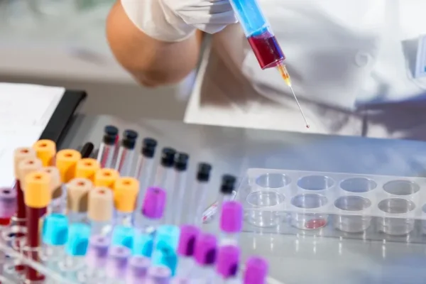 Laboratory worker handling blood samples in test tubes for diagnostic analysis.