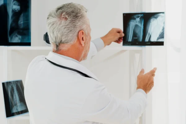 Doctor examining shoulder X-rays in a bright medical office.
